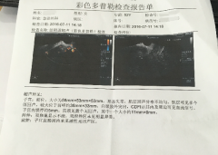 台湾试管婴儿-高龄好孕即将开奖