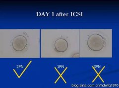 取卵数量多,为什么没有配成同样多的胚胎？