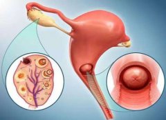 泰国试管婴儿引起宫外孕的几率大不大