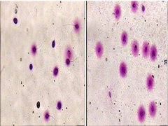 试管婴儿促排取卵为什么卵泡是空的?