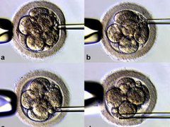 做试管婴儿都会有什么样的误区呢?